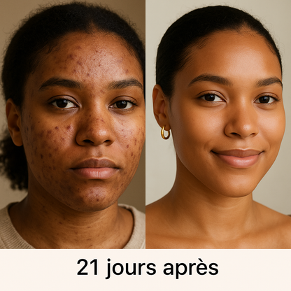 Masque Or Au Collagène 24K